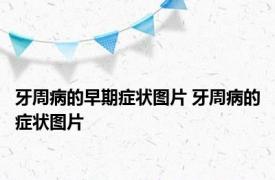 牙周病的早期症状图片 牙周病的症状图片 