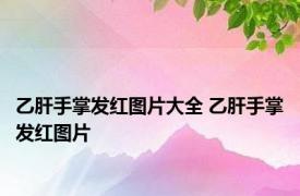 乙肝手掌发红图片大全 乙肝手掌发红图片 