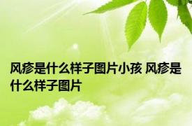 风疹是什么样子图片小孩 风疹是什么样子图片 