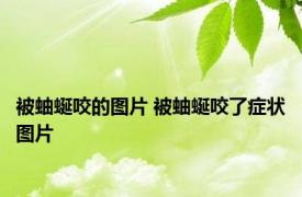 被蚰蜒咬的图片 被蚰蜒咬了症状图片 