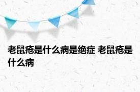 老鼠疮是什么病是绝症 老鼠疮是什么病 