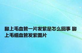 脚上毛血管一片发紫是怎么回事 脚上毛细血管发紫图片 