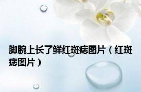 脚腕上长了鲜红斑痣图片（红斑痣图片）