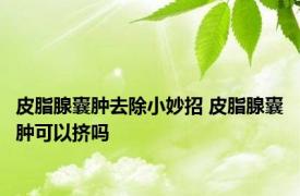 皮脂腺囊肿去除小妙招 皮脂腺囊肿可以挤吗 