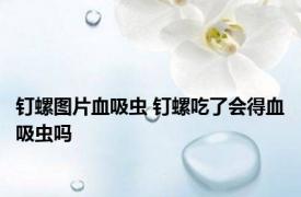 钉螺图片血吸虫 钉螺吃了会得血吸虫吗 