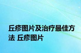 丘疹图片及治疗最佳方法 丘疹图片 