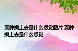 囊肿摸上去是什么感觉图片 囊肿摸上去是什么感觉 