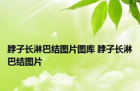 脖子长淋巴结图片图库 脖子长淋巴结图片 