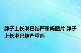 脖子上长淋巴结严重吗图片 脖子上长淋巴结严重吗 